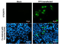 Pancreatic Polypeptide antibody [GT327]