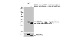 Hepatitis D virus Large delta + Small delta protein antibody [HL1055]