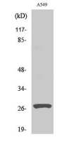 Cathepsin D (cleaved Leu169) antibody