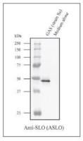 Streptolysin O antibody