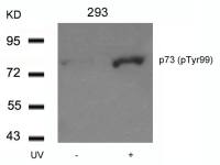 p73 (phospho Tyr99) antibody