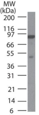 MLH1 antibody [164C819]