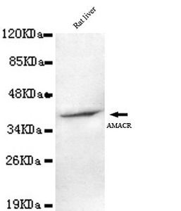 AMACR antibody [2F3-C11-B12]
