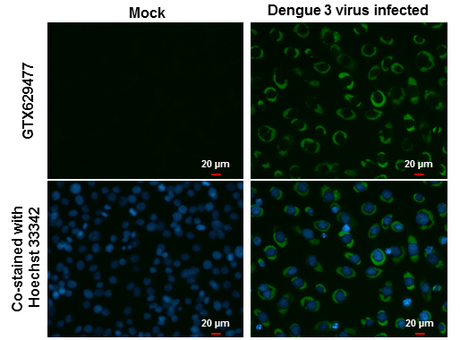Dengue virus NS3 protein antibody [GT2811]