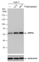NDP52 antibody [GT422]