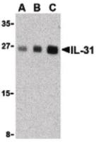 IL31 antibody
