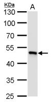 UQCRC1 antibody [GT139]