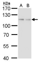 O-GlcNAc transferase antibody [GT2037]