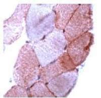 Dysferlin antibody (Ready-to-use)