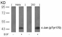 c-Jun (phospho Tyr170) antibody