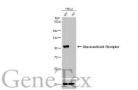Glucocorticoid Receptor antibody [HL1149]