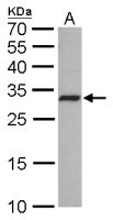 CDK4 antibody [GT624]