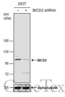 BICD2 antibody [GT1824]