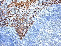 Cytokeratin 14 antibody [EPR1612]
