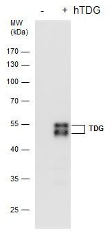 TDG antibody [GT622]