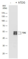 TDG antibody [GT622]