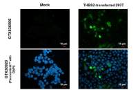 Thrombospondin 2 antibody [HL1194]