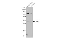 SMN1 antibody