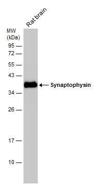 Synaptophysin antibody [GT1825]