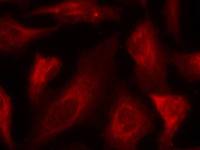 p53 (phospho Ser33) antibody