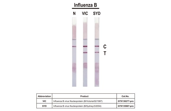 Influenza B virus Nucleoprotein (B/Victoria/02/1987), DDDDK Tag