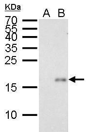 p21 Cip1 antibody [GT8611]