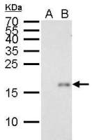 p21 Cip1 antibody [GT8611]