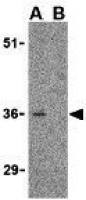 CTRP3 antibody