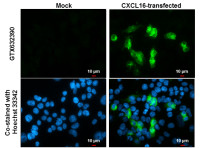 CXCL16 antibody [GT5212]