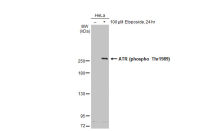 ATR (phospho Thr1989) antibody [GT222]