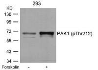 PAK1 (phospho Thr212) antibody