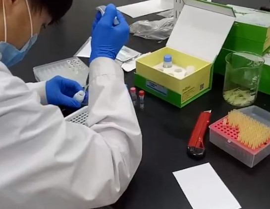 关于ELISA试验中必备的三个试剂你知道吗