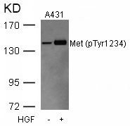 c-Met (phospho Tyr1234) antibody