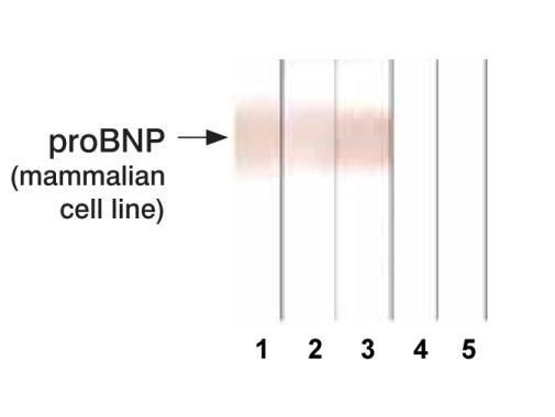 proBNP antibody [13G12]