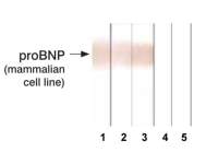 proBNP antibody [13G12]