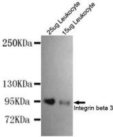 Integrin beta 3 antibody [3C12-G2-E4-H9]