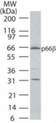 p66 beta antibody