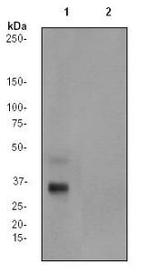 ATF1 (phospho Ser63) antibody [EP1591(2)Y]