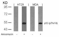 p53 (phospho Thr18) antibody