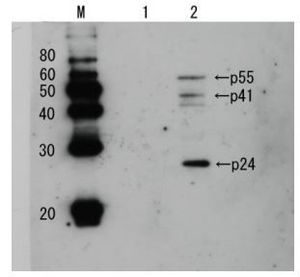 HIV1 p24 antibody (Biotin)