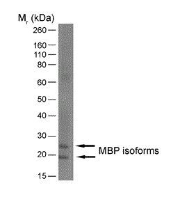 Myelin basic protein antibody [12]