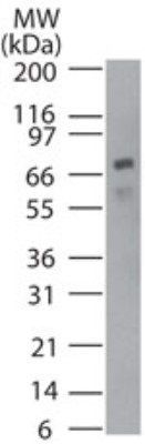 p73 antibody [5B789]