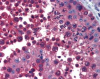 TCP1 beta antibody [4E217]