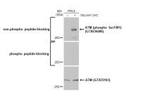 ATM (phospho Ser1981) antibody [HL1062]