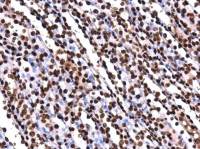 Histone H2AK5ac (acetyl Lys5) antibody [GT1262]