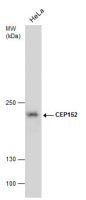 CEP152 antibody [GT1285]