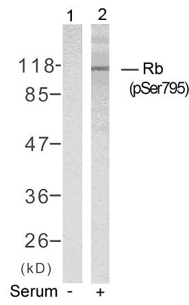 Rb (phospho Ser795) antibody
