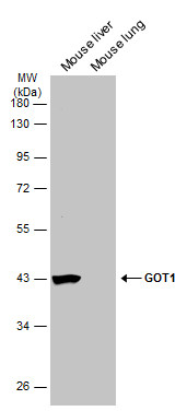 GOT1 antibody [GT638]