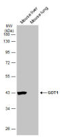 GOT1 antibody [GT638]