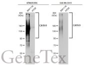 CA19-9 antibody [GT8510]